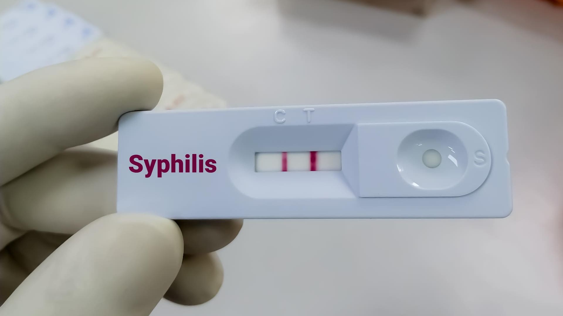 Test per diagnosticare la sifilide