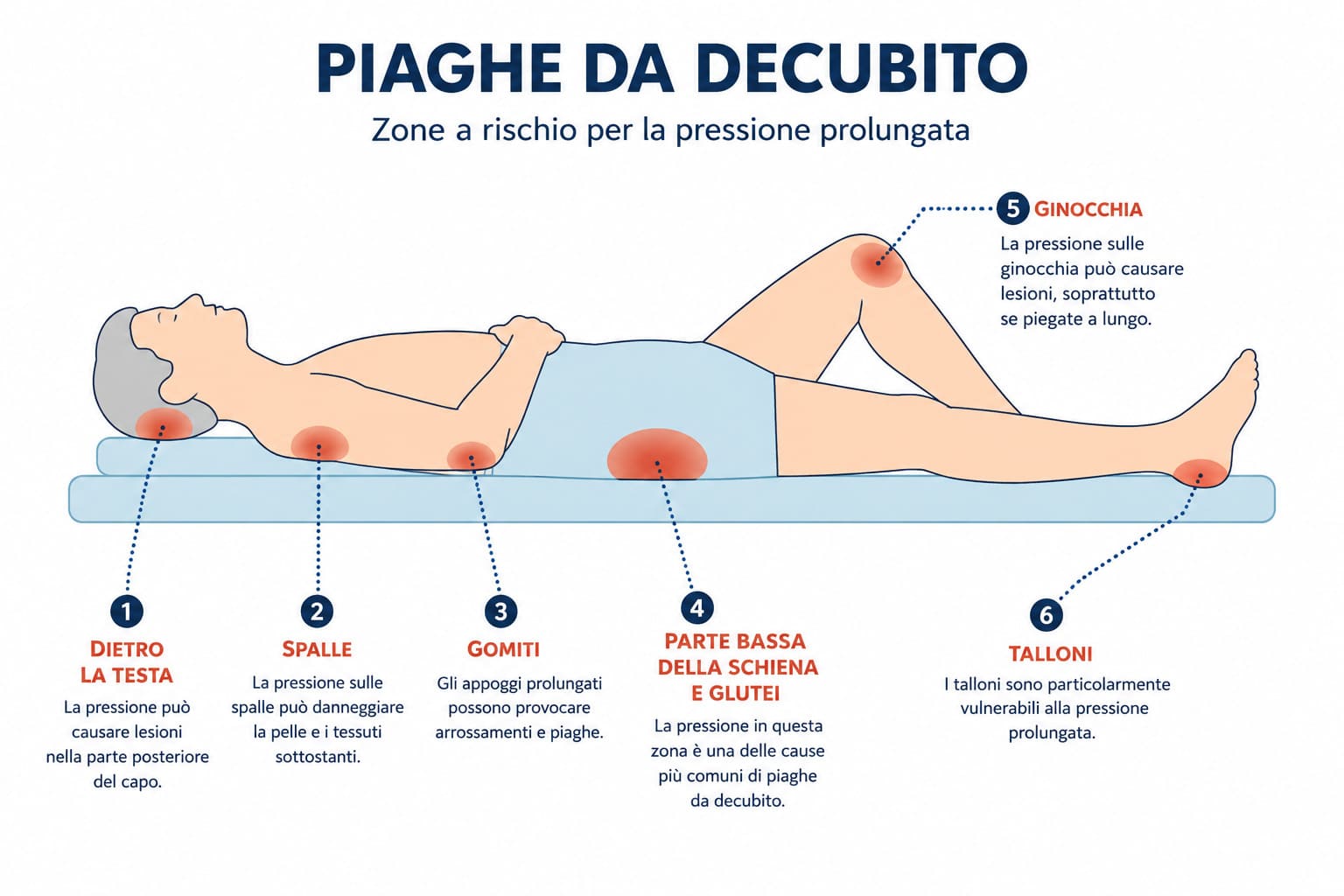 Piaghe da decubito zone maggiormente colpite
